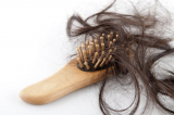 Inilah Penyebab Rambut Rontok Berlebihan